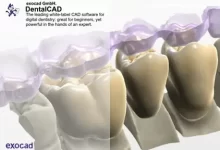 牙科exocad DentalCAD软件-红杏下载
